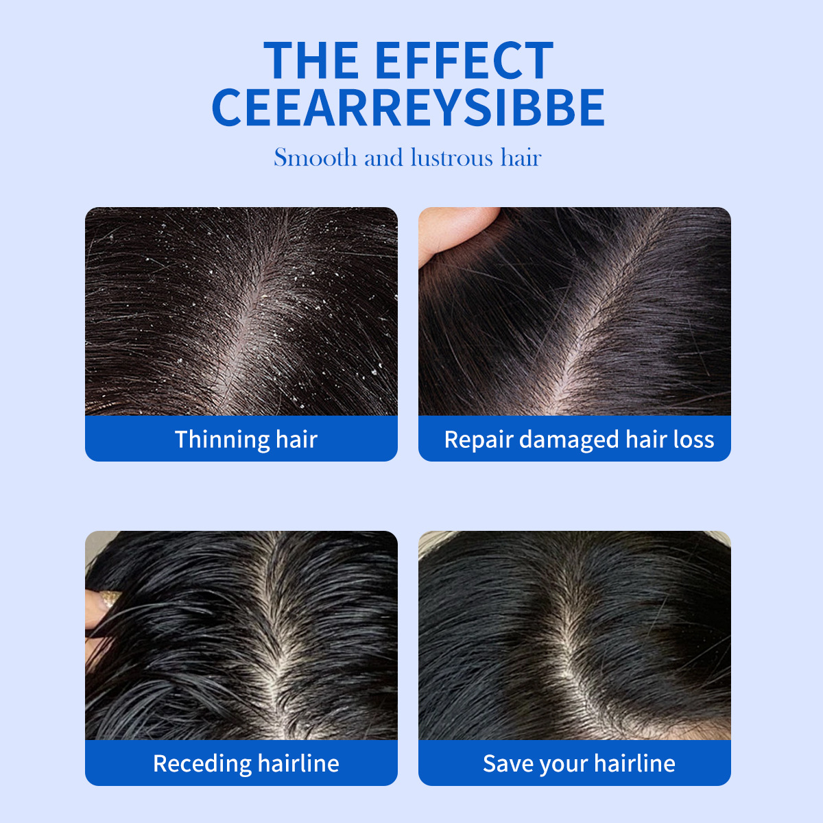 325ml Selenium Disulfide Anti  - đánh giá và giá Hair Care Dandruff